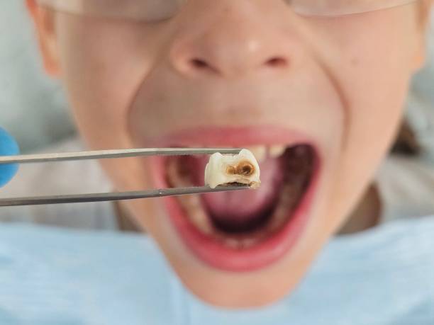 Best Broken Tooth Emergency  in Jefferson Valley Yorktown, NY